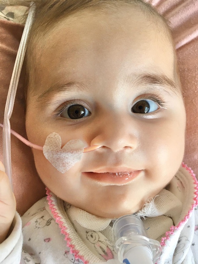 SMA HASTASI ZEYNEP SARE BEBEK YARDIM BEKLİYOR GÜNDEM