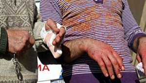 ACEMİ KASAPLAR HAYATINI TEHLİKEYE ATMASIN