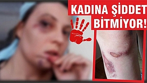 KENDİSİNDEN AYRILMAK İSTEYEN SEVGİLİSİNİ TEKME TOKAT DÖVDÜ