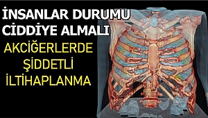 İŞTE KORONALI HASTANIN AKCİĞERLERİ