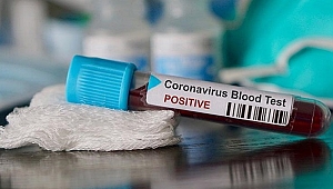 KORONAVİRÜS TESTİ KİMLERE YAPILACAK?
