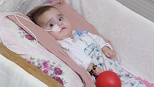 SMA HASTASI ZEYNEP SARE BEBEK YARDIM BEKLİYOR