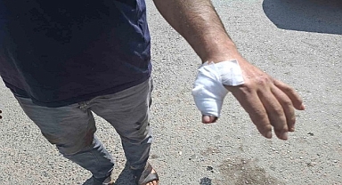 DÜZCE'DE150 ACEMİ KASAP KENDİNİ YARALADI